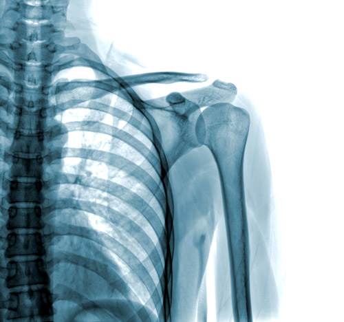 artroscopia alla spalla firenze dott colao ortopedico traumatologo